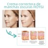 Ab La Crema Correctora De Manchas Aclara Las Manchas Oscuras