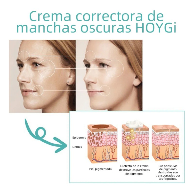 Ab La Crema Correctora De Manchas Aclara Las Manchas Oscuras