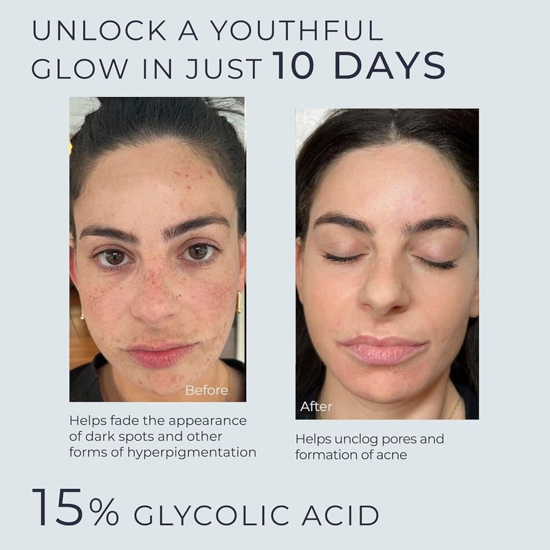 Instaskincare Glycolic Acid Serum for Face 15% Strength - Extra