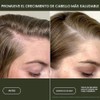 Scalp Care Density Serum by Living Proof for Women -