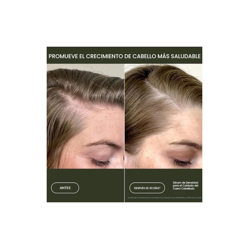 Scalp Care Density Serum by Living Proof for Women -