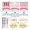 //arx Crema Antimicótica Para La Tiña Inguinal