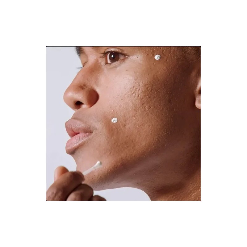 Malin + Goetz Acne Treatment Nighttime, 0.5 Fl. Oz. -