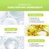 pure.tiful 2% Salicylic Acid (BHA) Serum for Acne & Blackheads