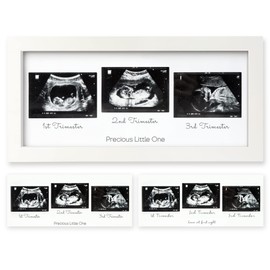Sonogram Picture Frame - Trio Ultrasound Picture Frames For Mom To Be Gift - Baby Ultrasound frame for Pregnancy Announcements - Baby Nursery Decor, Pregnant Mom Gifts (Alpine White)