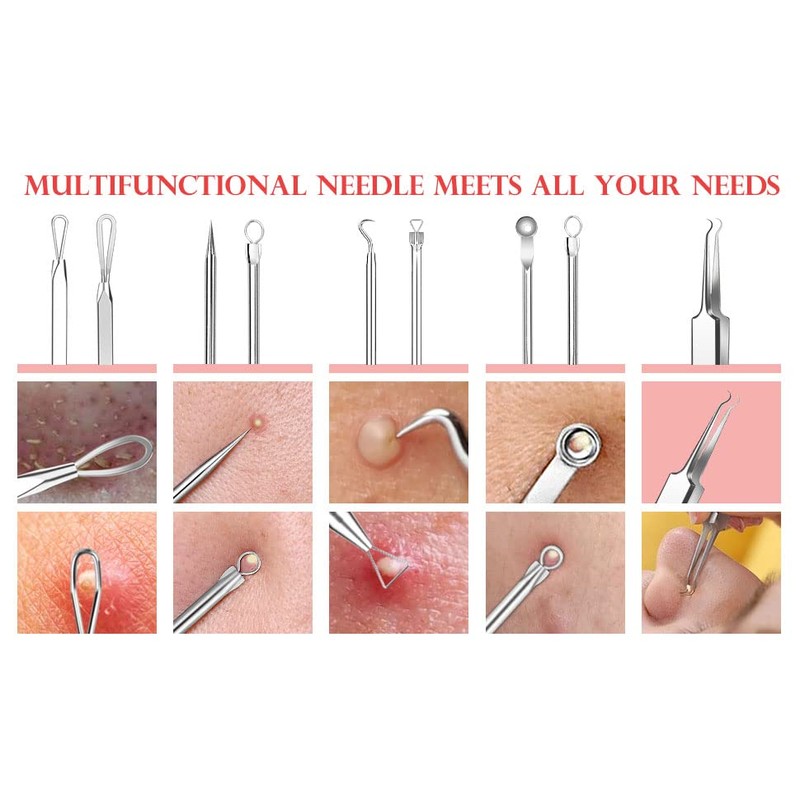 Whitehead Blemish Removal Tool Pimple Popper Tool Kit 8 Pcs