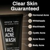 Shield System, Acne System for Men, Face Wash, Moisturizer, Pimple