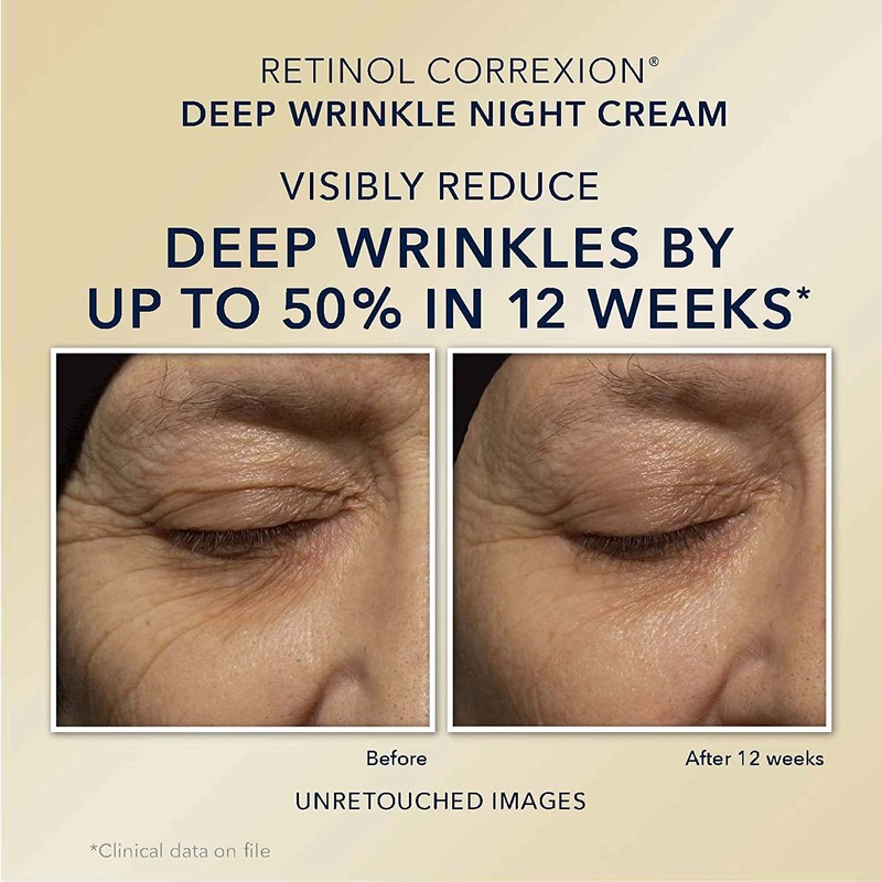 RoC Retinol Correxion Value Set Duo, Deep Wrinkle Anti-Aging Night