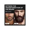 2pc Sérum Para El Crecimiento De La Barba Con Biotina