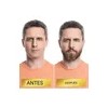 Suero Para Barba Hidratación, Cuidado Vello Facial + Rodillo