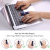 ACWOO Finger Splint, Pack of 2 Finger Smoother Finger Splint