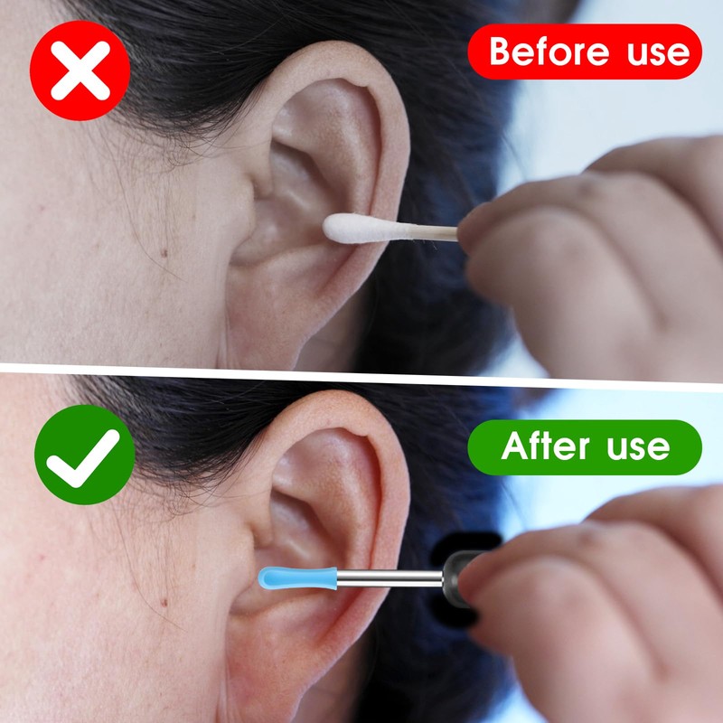 30 Pcs Ear Wax Removal Replacement Tips Replacement Tips Ear