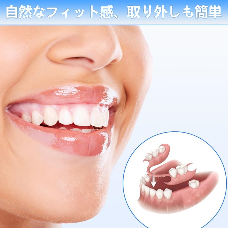Dentellea Custom Holley Retainer - Set of 2 - Wire