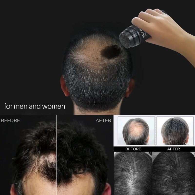 Polvo De Fibra Capilar Negro Cubre Raíz De Cabello Calvicie