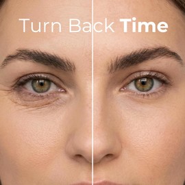 Retinol Super Eye Lift - Un lujoso tratamiento 3 en 1 combate el aspecto de círculos oscuros, arrugas y ojos hinchados