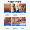 스마트 LED 초음파 치석제거기 셀프 스케일링 가정용 휴대용 Smart LED
