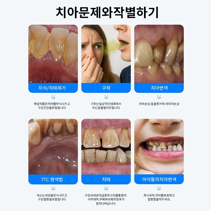 스마트 LED 초음파 치석제거기 셀프 스케일링 가정용 휴대용 Smart LED