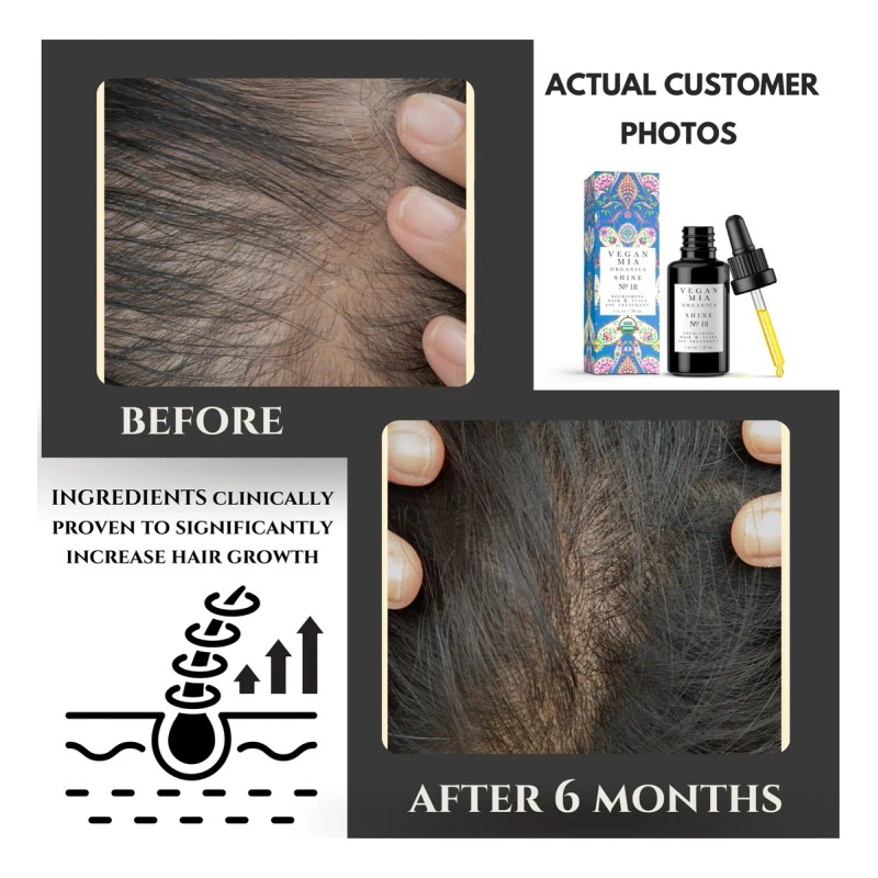 Tratamiento De Aceite Capilar Vegan Mia Usda Organic Con Ric