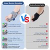 Generisch Hallux Valgus Correction Fixation Plate Upgrade Hallux Valgus Bunion