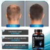 NutraPro Mens Hair Growth-Hair Vitamins For Men. Anti Hair Loss