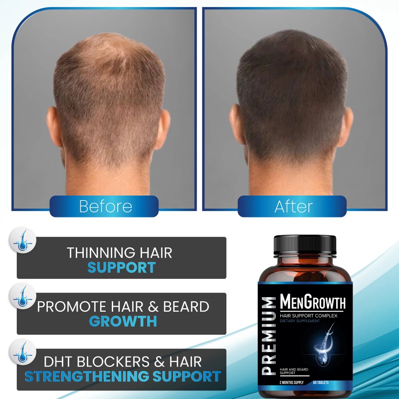 NutraPro Mens Hair Growth-Hair Vitamins For Men. Anti Hair Loss