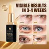 Retinol Eye Stick - Anti-Aging Cream for Dark Circles &