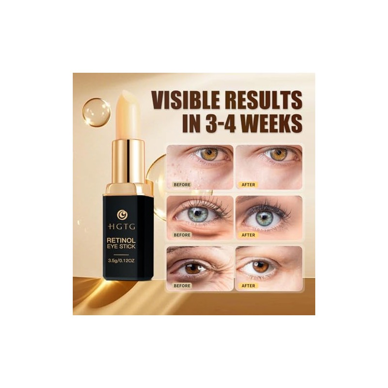 Retinol Eye Stick - Anti-Aging Cream for Dark Circles &