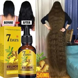 EELHOE 7 Day Fast Hair Growth Oil Ginger Growth Hair Treatment Anti Hair Loss Men Women Scalp Treatment Serum Products - Color: 40ml