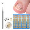 Ingrown Toenails Tool Set, Ingrown Toenails Correction