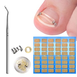 Ingrown Toenails Tool Set, Ingrown Toenails Correction