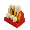 ideamall Implant Model Teeth Course Practice Model Educational Compact