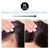 Pack Shampoo Anticaida Crecimiento Acelerado Anticaspa Reparador Hidratante Para Hombre