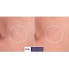 RETINOL VITAMIN A 5% + HYALURONIC ACID + Vitamin E