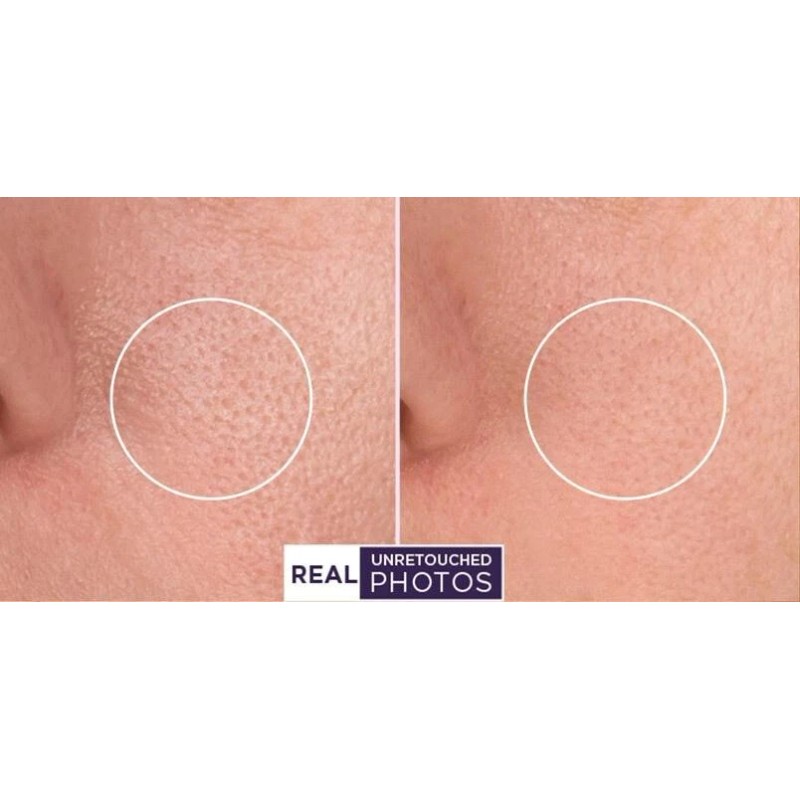 RETINOL VITAMIN A 5% + HYALURONIC ACID + Vitamin E