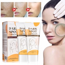 Tkekruh 2PC Sommersprossen Creme 60ml, Aufhellende Creme, Gesichtscreme Gegen Dunkle Flecken, Anti Pigmentflecken Gesicht, Whitening Cream, Flecken Creme, Altersflecken Creme, Pigmentflecken Entferner