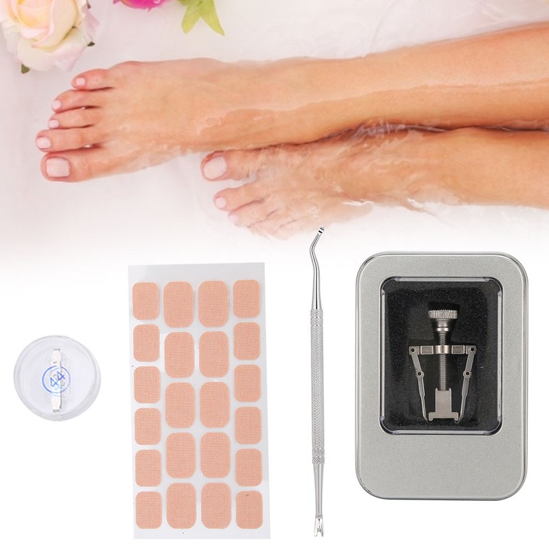 Ingrown Toenail Correction Patch Ingrown Nail Corrector Nail Insert Buckle