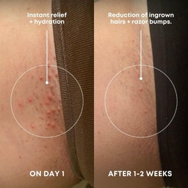 Bushbalm Ingrown Hair Exfoliating Scrub – Pre-Shave Sugar Scrub for Ingrown Hairs, Razor Bumps & Dry Skin – Gently Buffs & Soothes Sensitive Skin - Watermelon Sugar 236ml