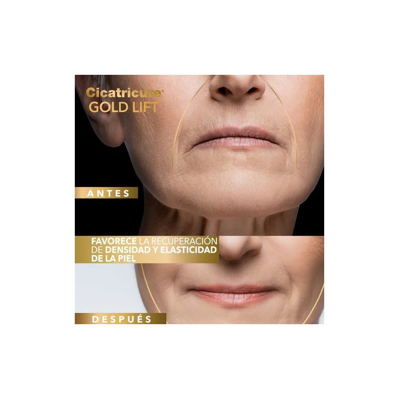 Cicatricure Crema Gold Lift Día – Resultados en 6 Semanas,
