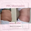 Monnaskin MESOLIPO PPC Cream Monnaskin 50g