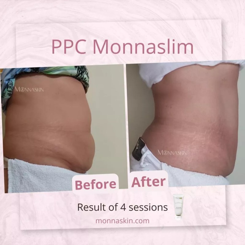 Monnaskin MESOLIPO PPC Cream Monnaskin 50g