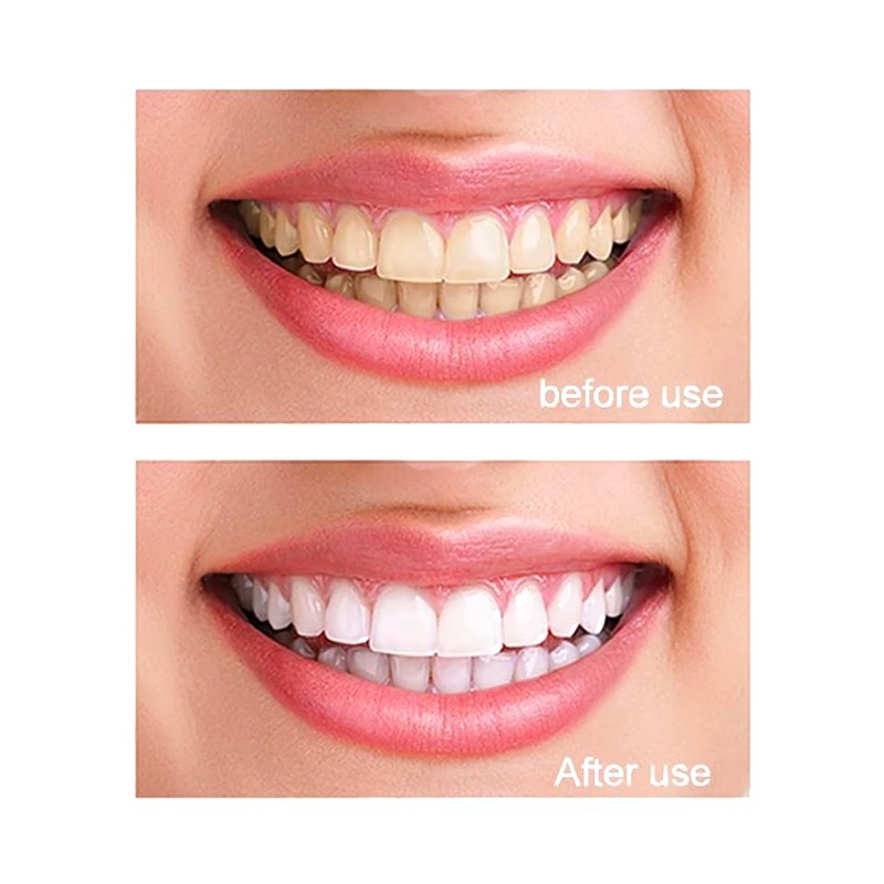 100% Pure Nano Hydroxyapatite Tooth Powder – Enamel Remineralization Support,