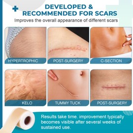 Rvlaim Silicone Scar Sheets, Silicone Scar Tape(1.6”x 120” Roll-3M), Silicone Scar Strips, Professional Scar Removal Sheets for Surgical Scars, Keloid, C-Section, Burn et