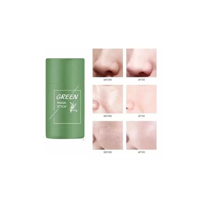 Veze Mascarilla Verde Barra Original Adiós Acné Puntos Poros