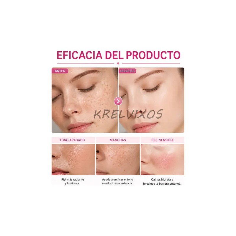 Crema De Arbutina 7% + Ácido Tranexámico Al 4%, 70.000