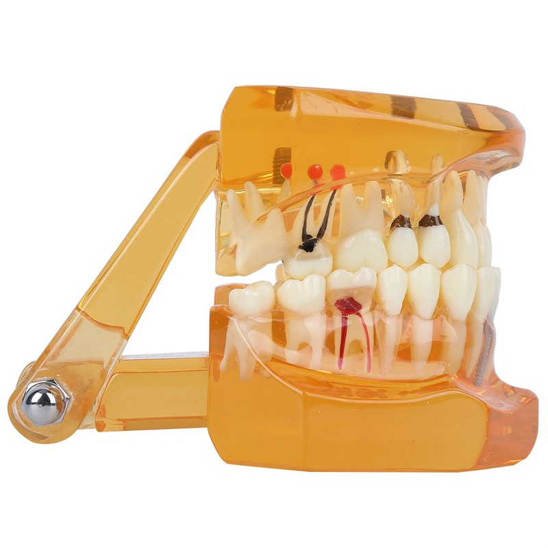 1pc Orange Color Dental Disease Removable Study Teaching Teeth Model