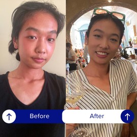 IBLUSH Asian Flush Patches - 12 Discreet, All Natural Patches - Fast, Effective & Backed by Science