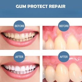 3PCS Gum Repair Gel,Gum Shield Therapy Gel for Receding Gums,Advanced Gu/m Treatment & Protection,Deeply Cleaning G/ums & Teeth,Promotes Gu/m Regrowth & Teeth Repair,Supports Gu/m Health,Oral Care