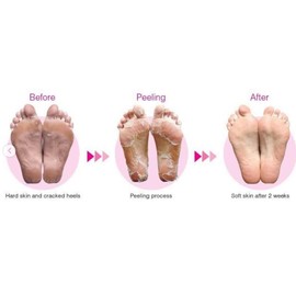 Bathefex Softsole Express Exfoliating Foot Peel Sachet