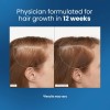 Esencia Enrollable De Romero Para El Crecimiento Del Cabello