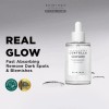 Kit Aclarador Tonos Skin1004 Madagascar Reduccion Manchas